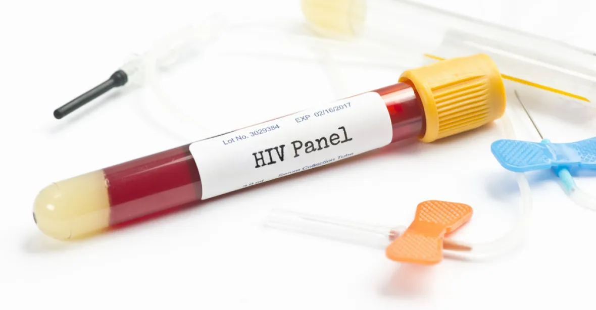 V Česku se objevila padělaná balení léku proti HIV