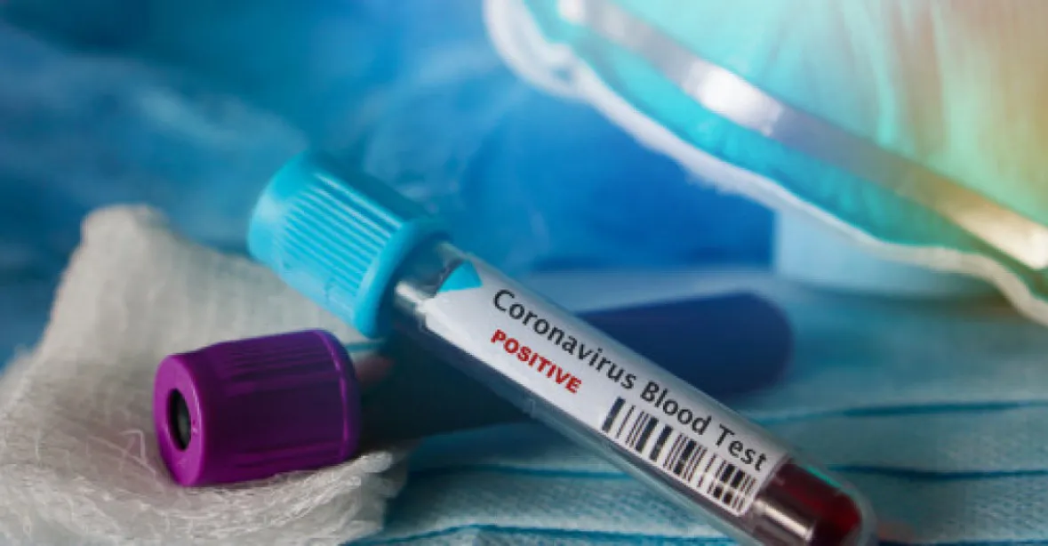 Číňané chtějí proti koronaviru použít lék, který vyvinul Čech