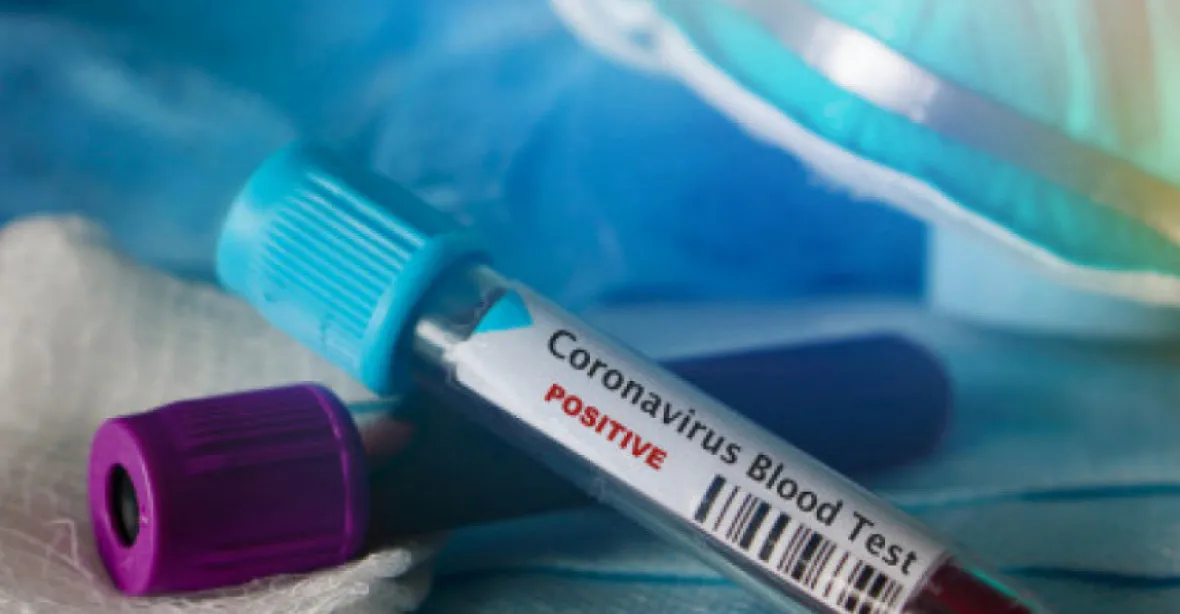 První úmrtí na koronavirus v Evropě. Ve Francii podlehl nákaze 80letý muž