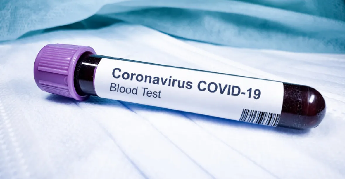 Americká špionáž věděla o novém koronaviru od listopadu, uvedla CNN