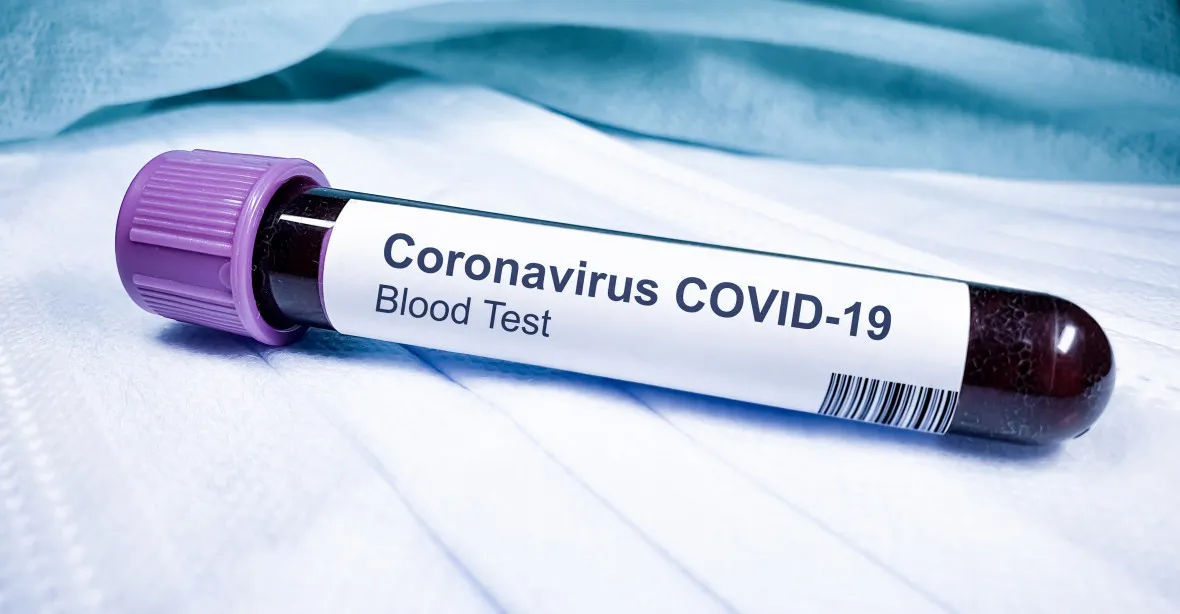 Hygienici odhalili nové ohnisko koronaviru na Liberecku