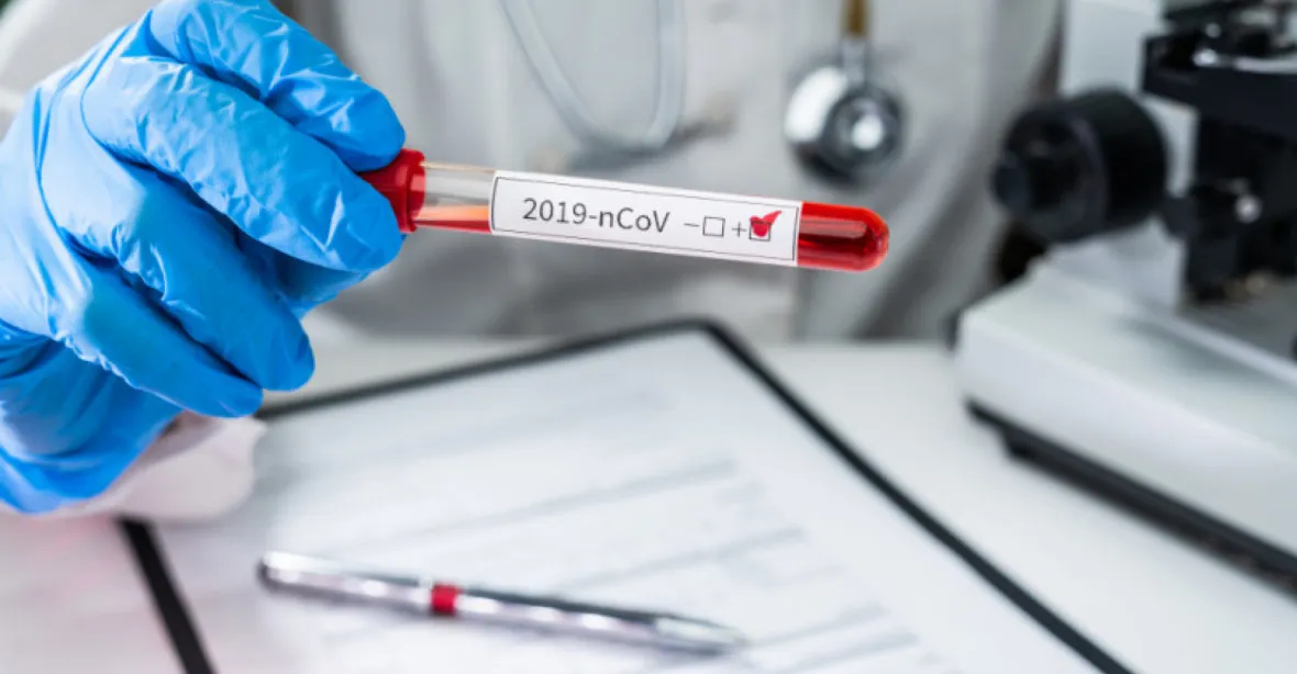 Covid s novou vládou: PCR testy, konec uzavírání tříd, Válek se vyjádří k protilátkám